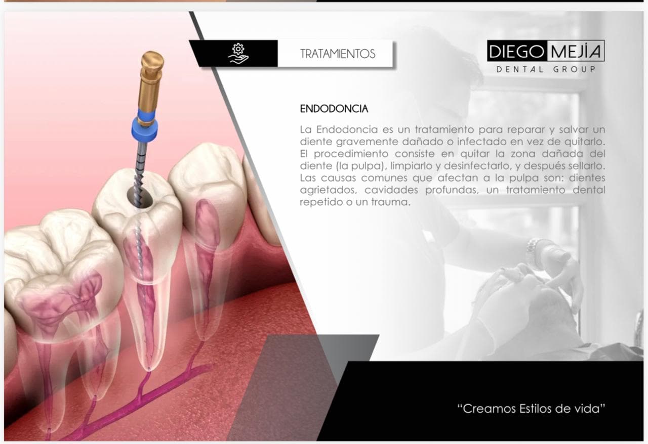 Endodoncia