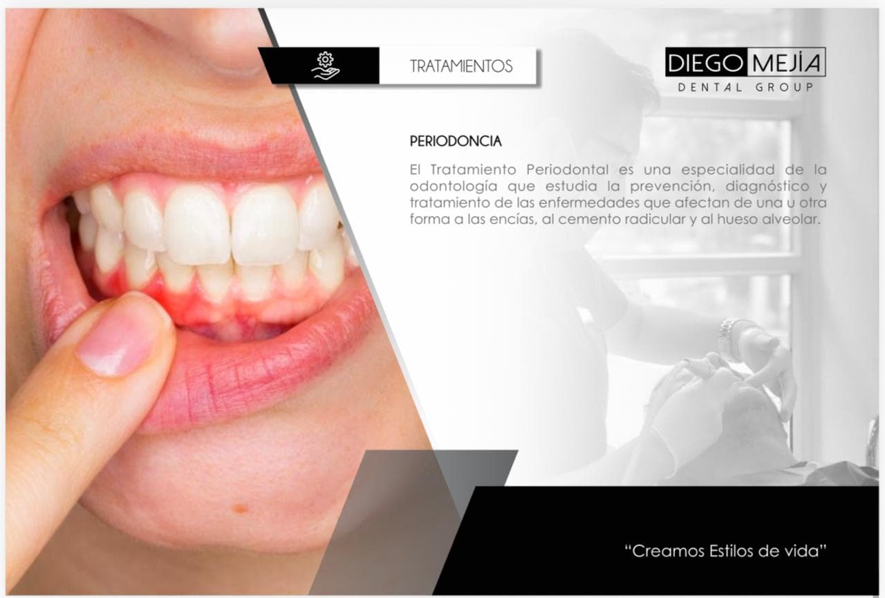 Periodoncia